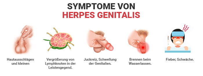 Genitalherpes (Herpes Genitalis) .